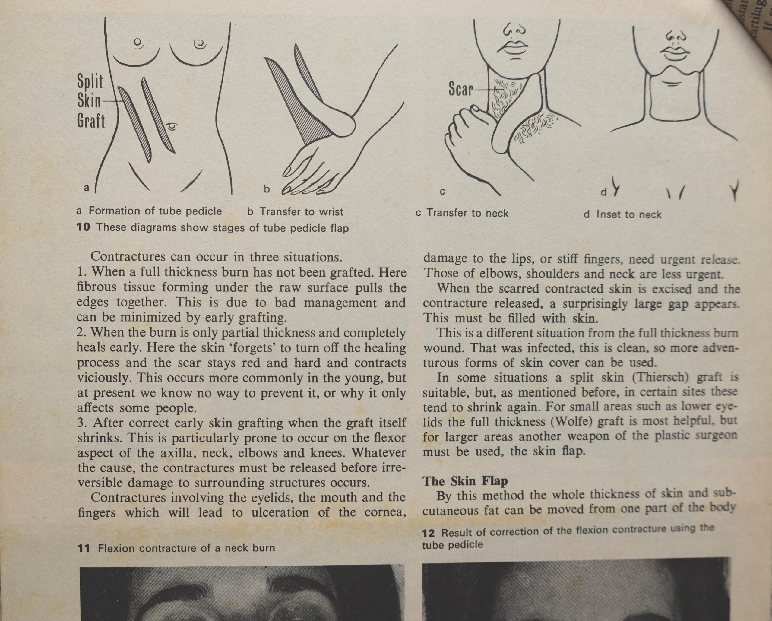 1970_6_Burns-drawings-4
