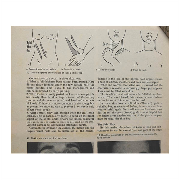Burns drawings 4